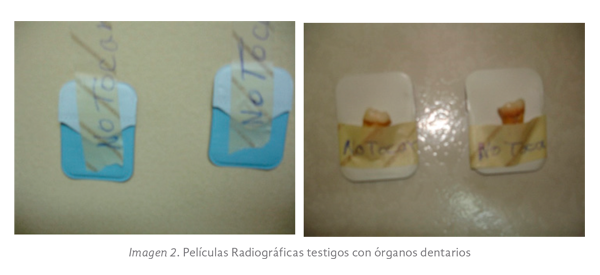 Imagen 2. Películas Radiográficas testigos con órganos dentarios